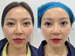 -上海伊莱美医疗美容医院