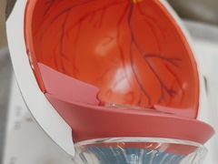 -武汉大学附属爱尔眼科医院(湖北总院)