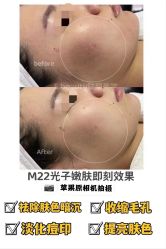 -E.beauty驻颜·痘敏肌调理中心