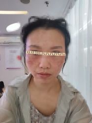 体验后-深圳美莱医疗美容医院
