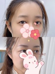 -久匠半永久纹眉