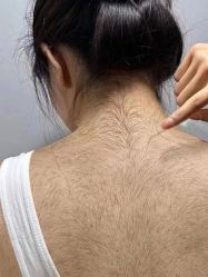 -薇兰专业脱毛连锁机构