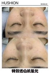 -LUNA皮相美·骨相美高级美感