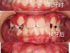 -精德口腔·种植修复·儿牙中心(财富中心店)