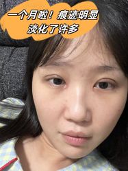 -素美医疗美容·西南眼鼻整形·修复基地