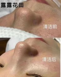 -苗方清颜痘肌研究所