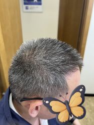 点击看大图 -大麦微针植发全国连锁