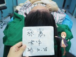 -大麦微针植发丨全国连锁