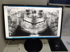 -牙易美口腔(圣堂店)