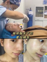 -西安壹加壹医疗美容·西北抗衰旗舰店
