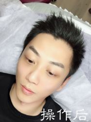点击看大图 -西施无菌半永久纹绣眉眼影唇轻增发纹发际线