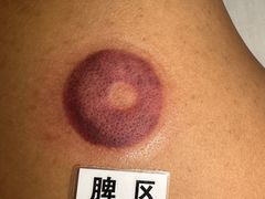 -莱仪堂艾灸经络养生馆(九亭一店)