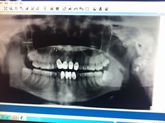 爱贝口腔-爱贝口腔·牙周诊疗·种植修复中心