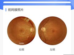 -宝岛眼镜(苏州浒关店)