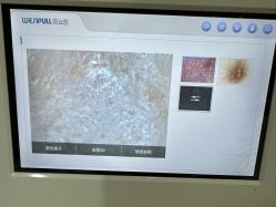 -成都苗方清颜专业祛痘