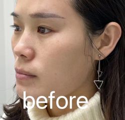 点击看大图 体验前-CMS西美斯·美式医疗美容