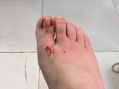 -新甲连锁灰指甲·甲沟炎·鸡眼(黑龙江路店)