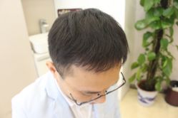 -大麦微针植发全国连锁