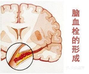 护血管、促循环，受益一辈子