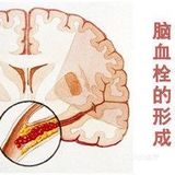 护血管、促循环，受益一辈子