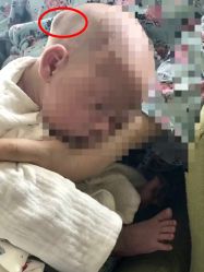 暴力对待新生儿！！！！-西安市儿童医院门诊