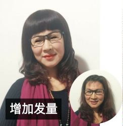 点击看大图 -发饰美男士增发补发假发定制店