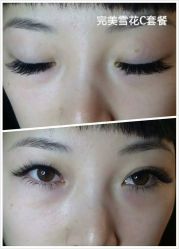 睫毛嫁接-光SPA科技美肤