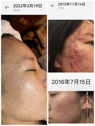 -皇族养心堂·净痘·修敏·御颜