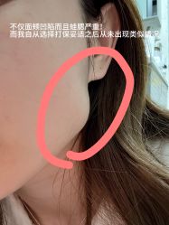点击看大图 -广州美莱医疗美容医院