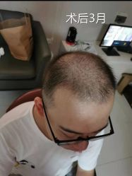 -雍禾植发全国连锁