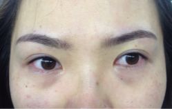眉毛.眼线一气呵成-平萍纹绣韩式半永久定妆