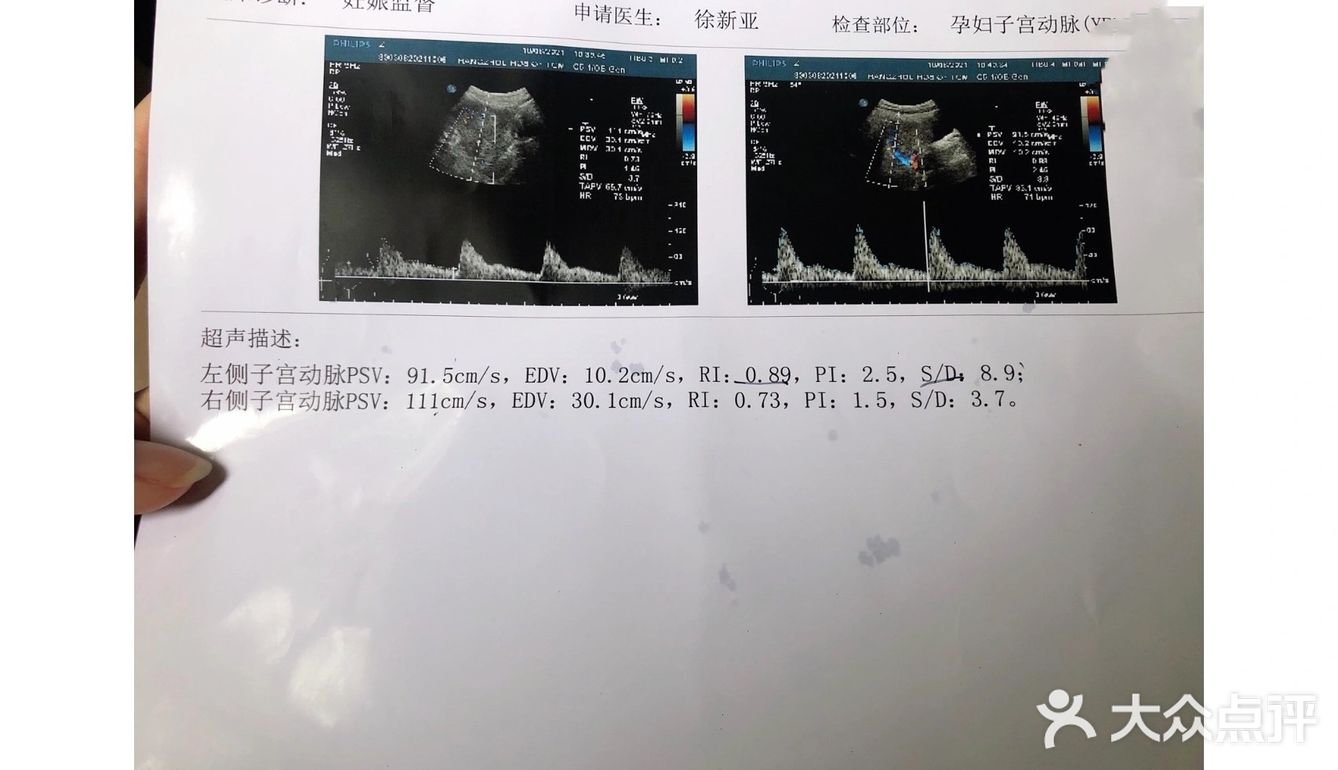 孕早期症状表现及缓解方法特辑