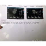 孕早期症状表现及缓解方法特辑