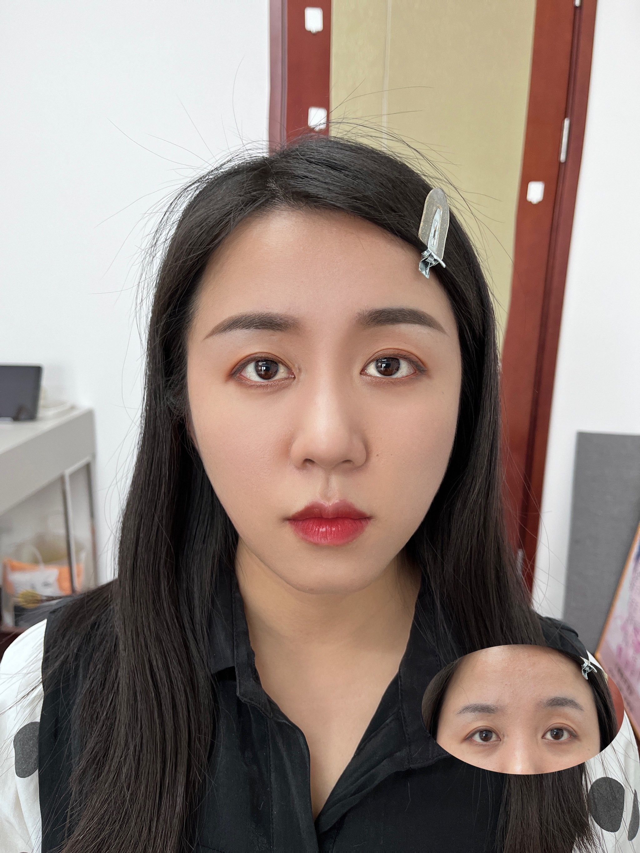 调整不对称眉毛