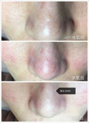 opt光疗-光SPA科技美肤