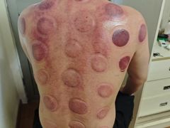 -沈师傅盲人按摩工作室(密三小区店)