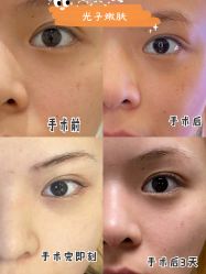 -广州健丽·去眼袋医疗美容机构