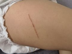 -首都医科大学附属北京潞河医院