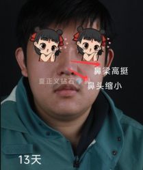 -北京米扬丽格医疗美容·联合丽格鼻整形中心
