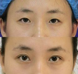 -紫洁俪方（北京）医疗美容