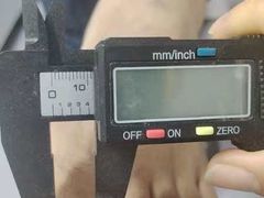 -祖传修脚甲沟炎灰指甲鸡眼