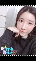 体验后-大麦微针植发全国连锁