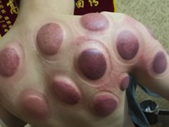 -御筋堂正骨推拿(星源国际店)