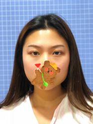 点击看大图 体验前-南京康美美容医院·旗舰店