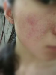 -丽美妍医疗美容·皮秒·立体分层抗衰