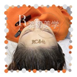 -RC半永久纹眉纹发际线