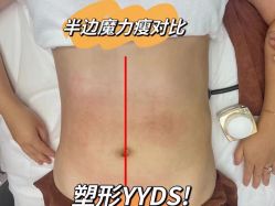 -Lily纤美·科技减脂中心