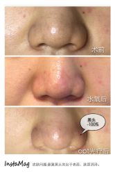 脸部抗衰-光SPA科技美肤