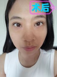 -素美医疗美容·西南眼鼻整形·修复基地