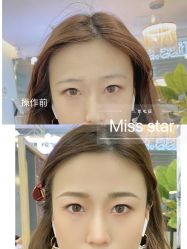 -MISS STAR·半永久纹眉·发际线·美瞳线